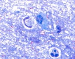 Löfflers Methylenblaulösung für die Mikroskopie, 1 * 100 ml,