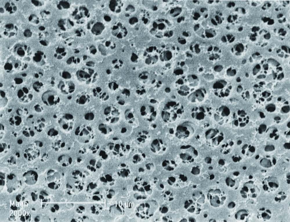 Membranfilter Typ 111, Celluloseacetat, steril